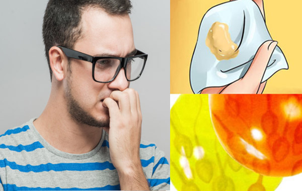tinh trùng màu vàng là dấu hiệu của bệnh gì?